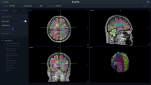 wowtale.net vuno med deepbrain - 와우테일