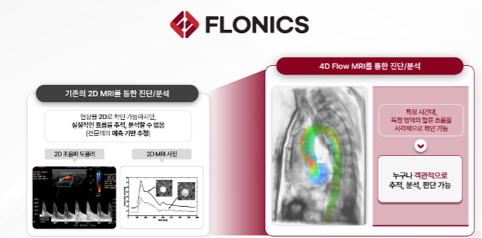 4D Flow MRI - 와우테일