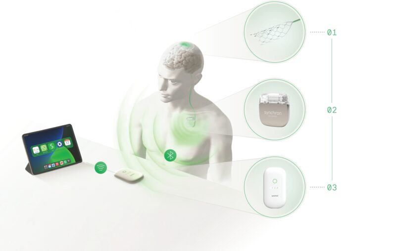 싱크론, 뇌-컴퓨터 인터페이스 기술 고도화 위해 2억 달러 투자 유치 1 Synchron MDC Image Transparent - 와우테일